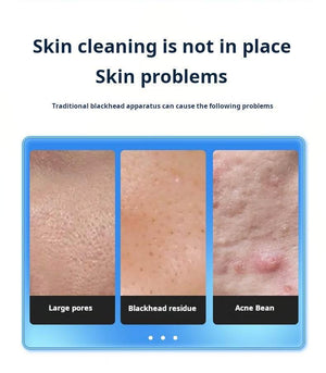 جهاز تنظيف البشرة الفقاعي بالماء والشفط Water Bubble Facial Cleaner.