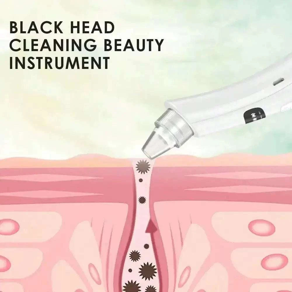 جهاز Blackhead Remover لإزالة الرؤوس السوداء وتنظيف المسام.