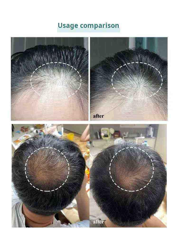 ViveLab 🌿 عرض الباكج المتكامل للشعر والرموش + جهاز تجعيد حراري – 6 قطع.