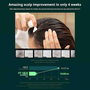 Hair Treatment - Vivelab Hair & Scalp Enhancing Foam | علاج مكثف لزيادة الكثافة والقوة لشعر صحي أكثر كثافة وحيوية 🌿.