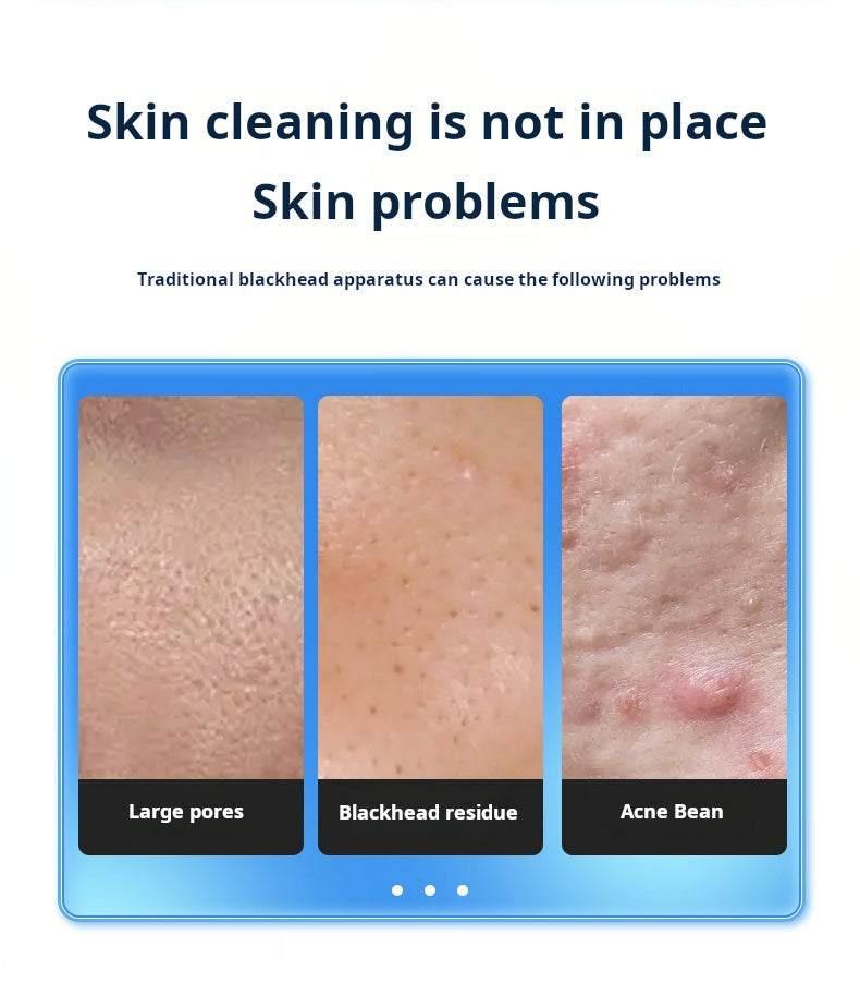 جهاز تنظيف البشرة الفقاعي بالماء والشفط  Water Bubble Facial Cleaner.